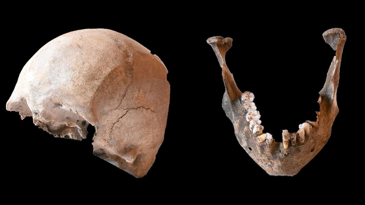 This skull and mandible, rumored to belong to Pliny the Elder, prompted new research to assess that claim. 