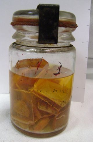 preserved brain tissue from dementia patient who died in the 1930s.