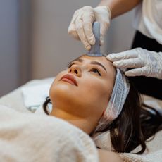 Woman on a treatment table having a facial cupping treatment