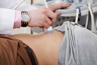 An abdominal ultrasound on a woman.