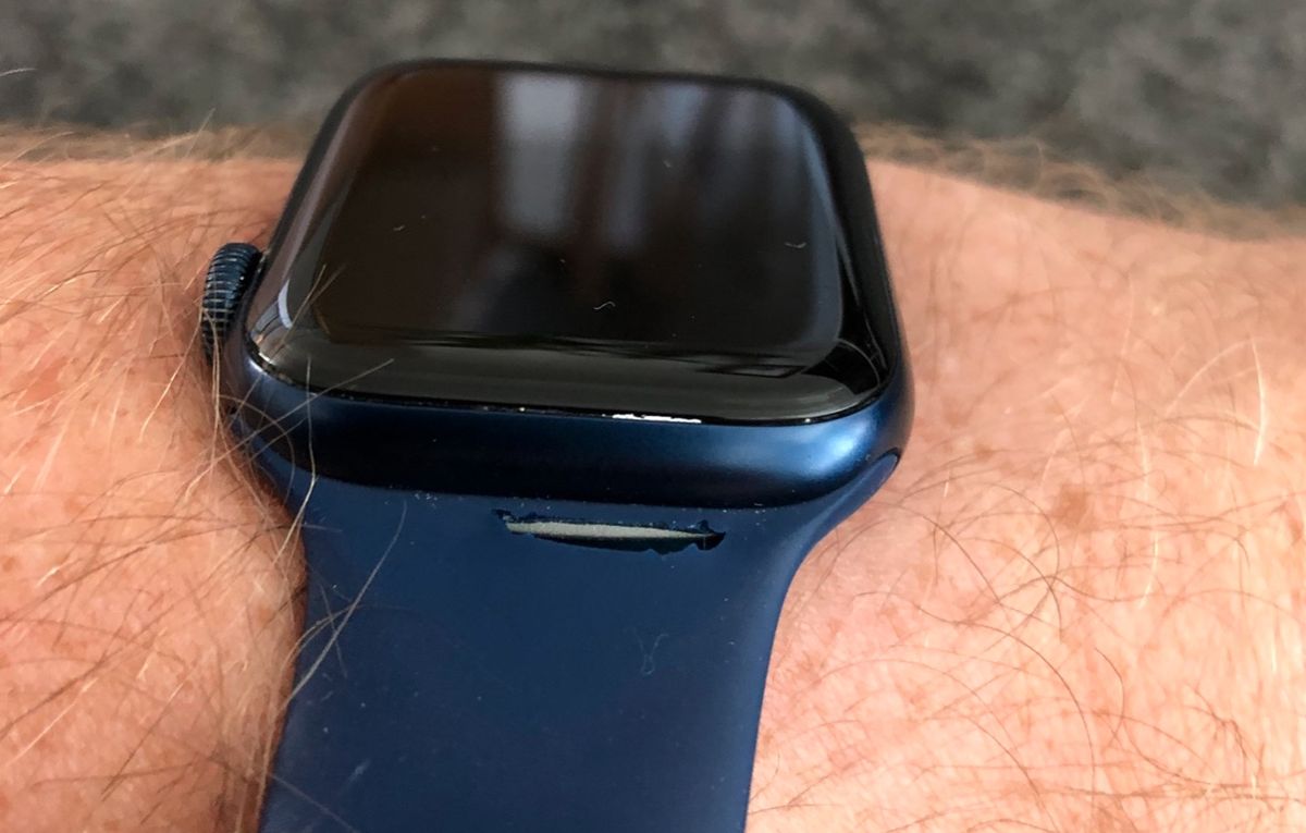 A Year On Some Apple Watch Solo Loops Arent Standing The Test Of Time