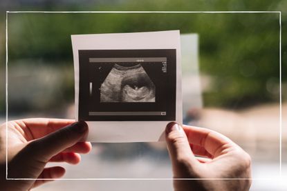 Ramzi theory as illustrated with an image of a woman holding up a baby scan