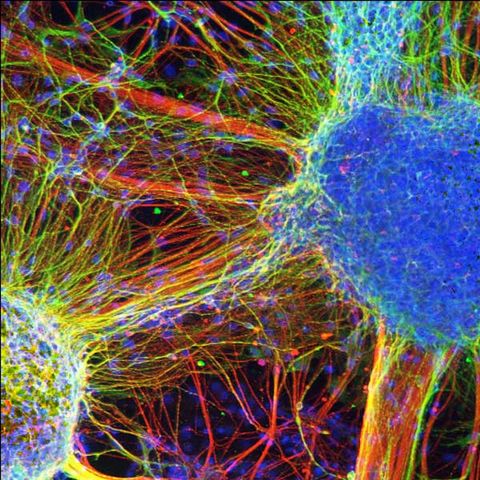 Schizophrenic Brain Cells Created in Lab | Live Science