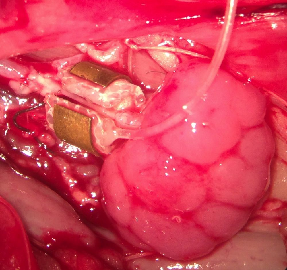 fetal kidney