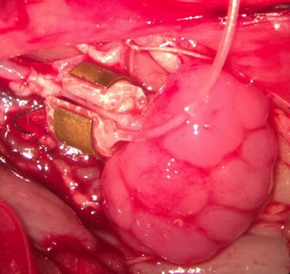 fetal kidney