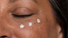 menopausal skin