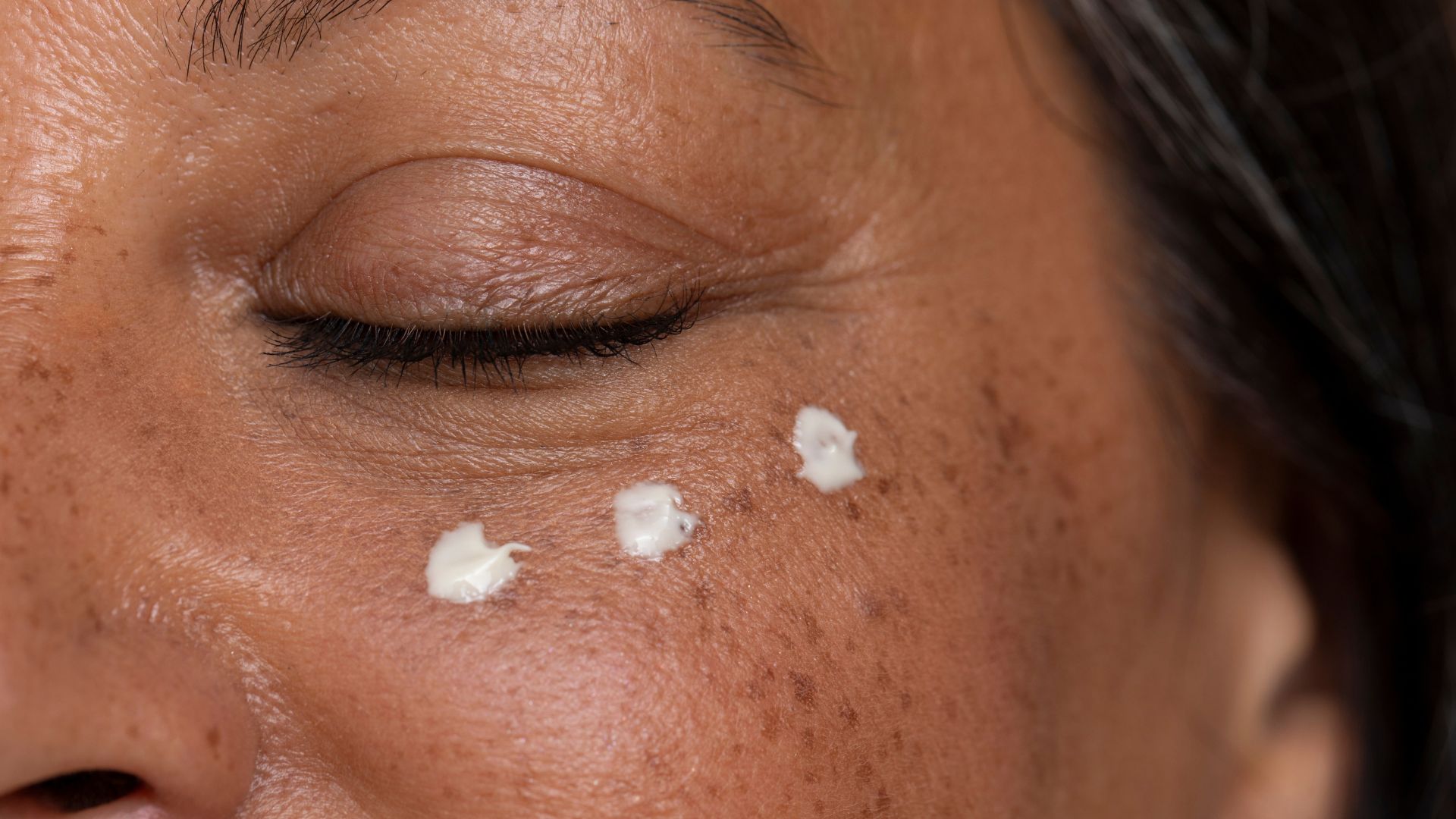 menopausal skin