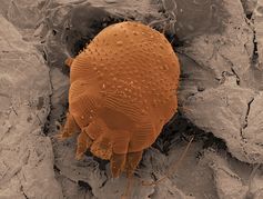 Microscopic scabies mites live on the skin.