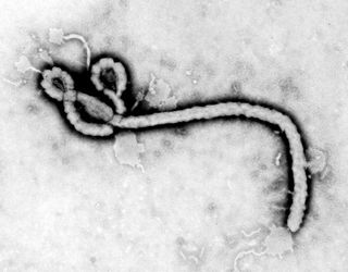 This Ebola virus, as seen through a transmission electron microscope.