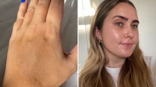 composite of swatch of miracle balm on hand vs on face