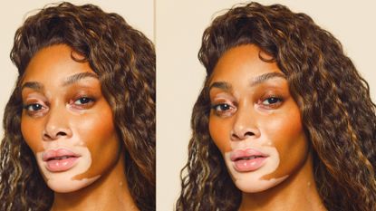 Unfiltered with Winnie Harlow