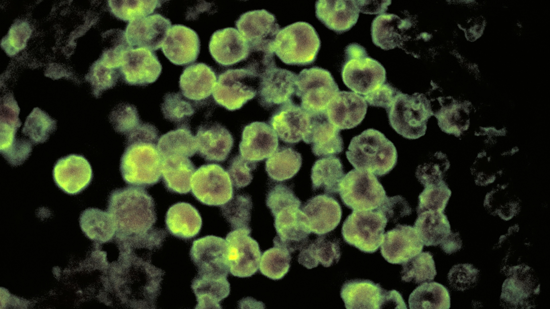 A fluorescence microscopy image of green glowing circles, the histopathologic characteristics associated with a case of amoebic meningoencephalitis due to Naegleria fowleri