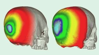 Two skulls with parts of the bones highlighted by rainbow colors