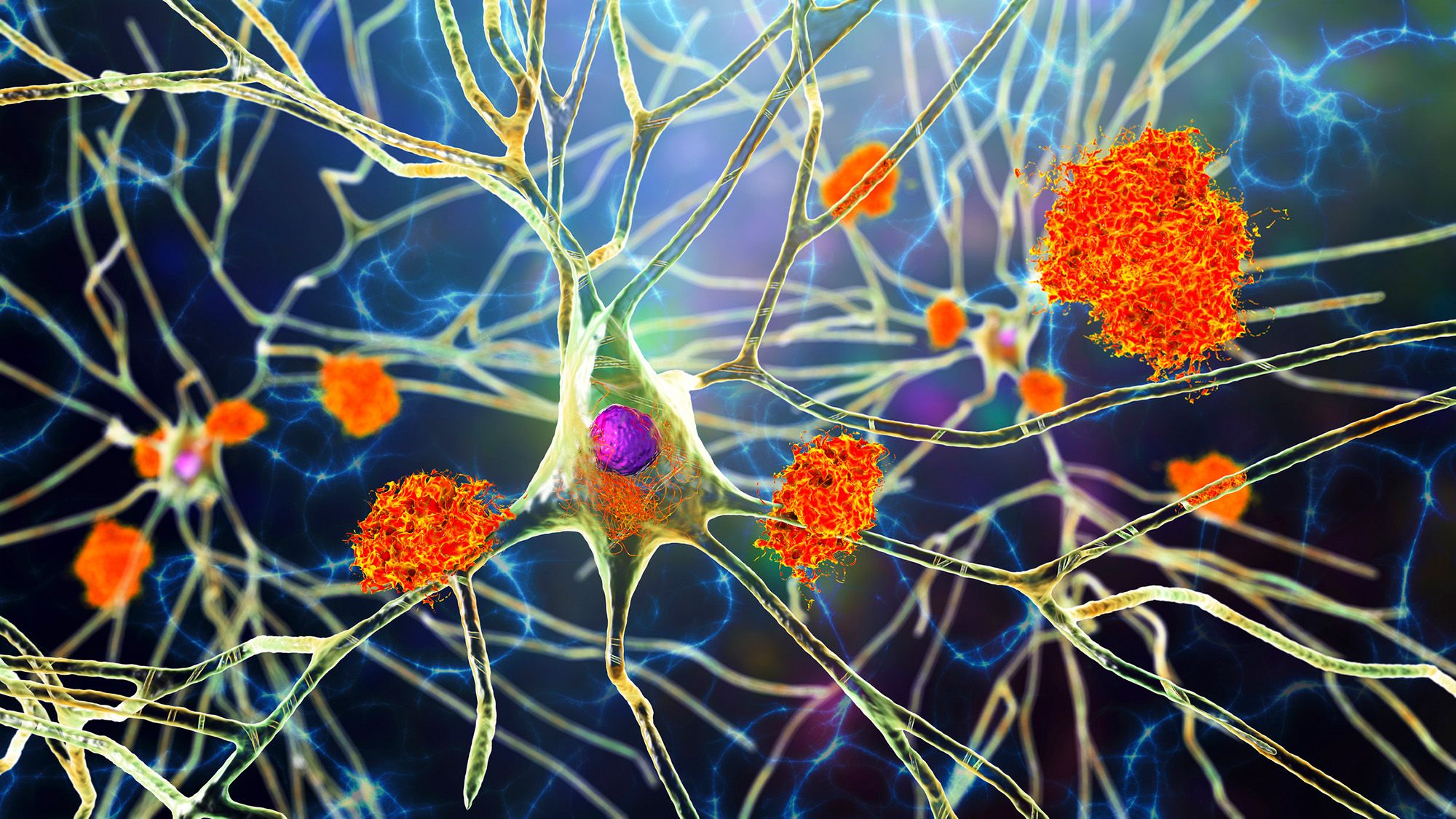 An illustration stringy neurons with orange cells on them.