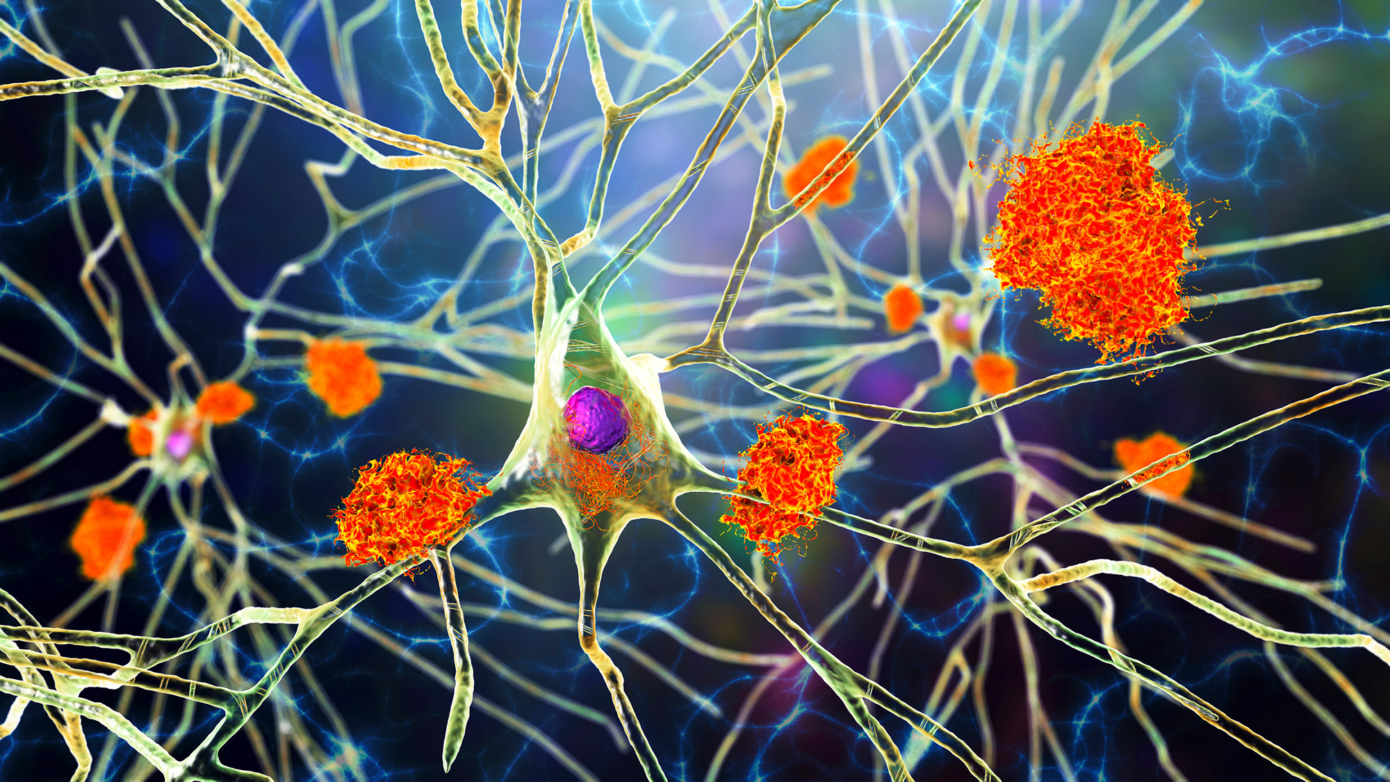 An illustration stringy neurons with orange cells on them.