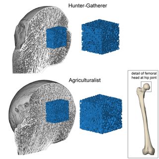 3D renderings of the femoral head at the hip joint. The femoral head has been sectioned to reveal the 3D volumes of trabecular bone for hunter-gatherers (top) and agriculturalists (bottom)..