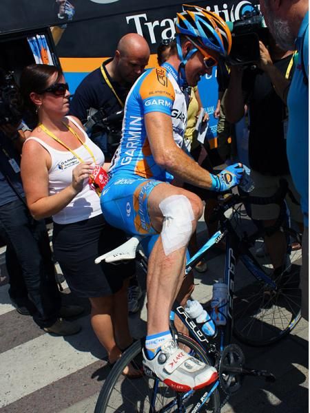 Farrar's knee bears the signs of yesterday's crash.