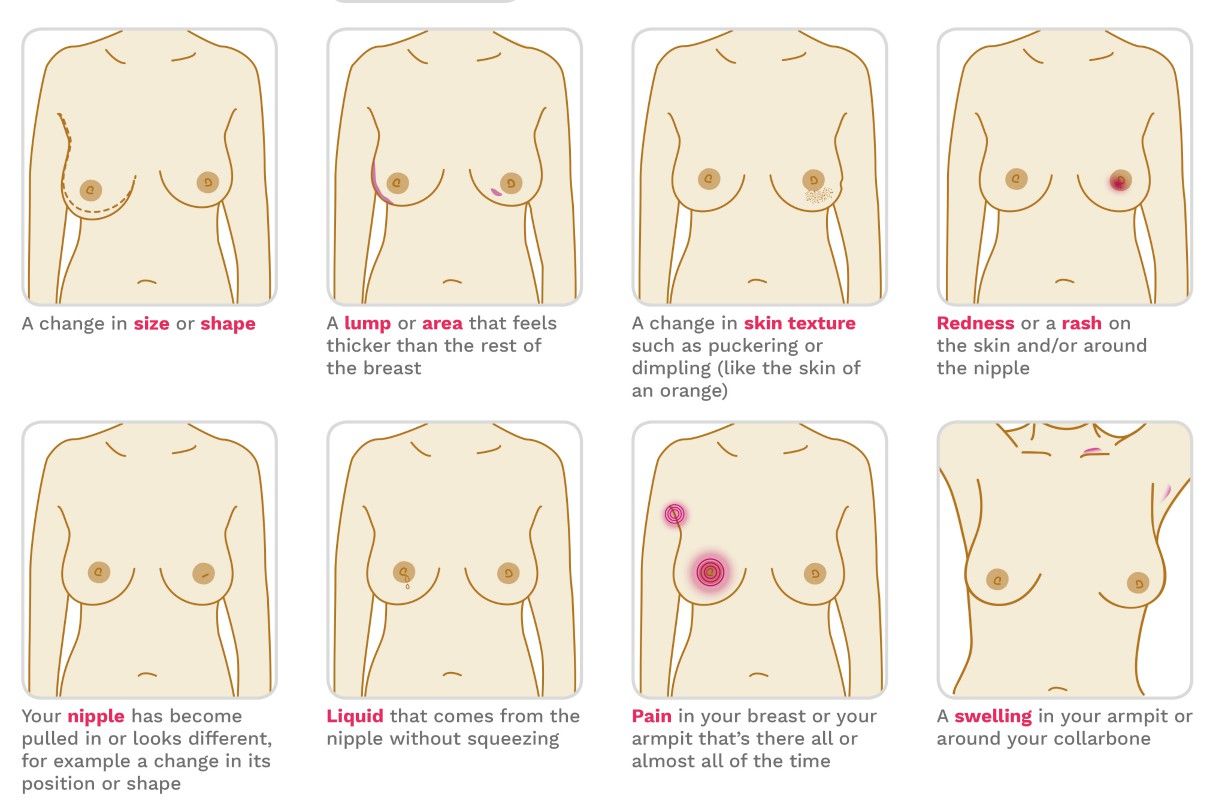 How to check your breasts