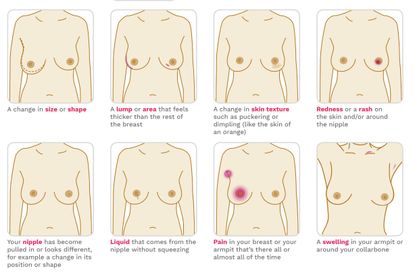 Signs of breast cancer: How to check your breasts