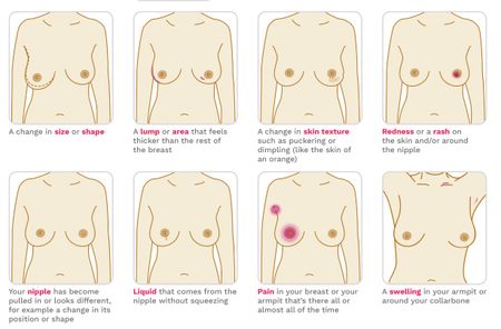 How to check your breasts