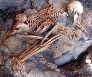 Most victims of fire have a so-called pugilistic pose in death, with their arms and legs drawn up, as can be seen with this adult male skeleton found in an ash deposit from the A.D. 79 eruption of Mount Vesuvius.