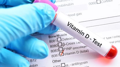 A new study links Vitamin D deficiency to Covid-19