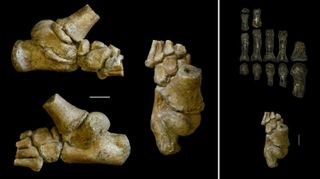 Left block of images: The 3.32 million-year-old foot from an Australopithecus afarensis toddler shown in different angles. Right block of images: The child's foot (bottom) compared with the fossil remains of an adult Australopithecus foot (top).