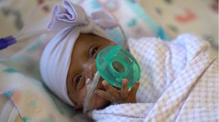 A newborn in San Diego nicknamed baby "Saybie" is the the world's smallest surviving premature baby. Above, Saybie in March 2019, when she was around 3 months old and weighed 3 lbs.