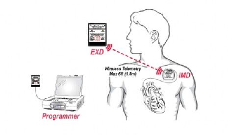 The AngelMEd Guardian implant alerts patients suffering from heart disease to impending problems using vibrations, tones, and lights.