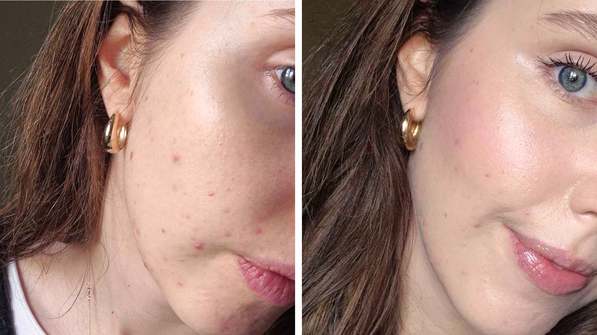 On the left is a close-up of the side of Digital Beauty Writer, Naomi Jamieson's face, showing her skin without any makeup on, followed by a picture on the right, showing Naomi's cheek but with the Chanel Water-Fresh Complexion Touch applied, along with the rest of her favourite makeup products - to demonstrate the before and after effects.