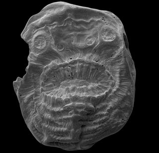 A scanning election microscope (SEM) took this detailed image of the deuterostome with the extra-large mouth.