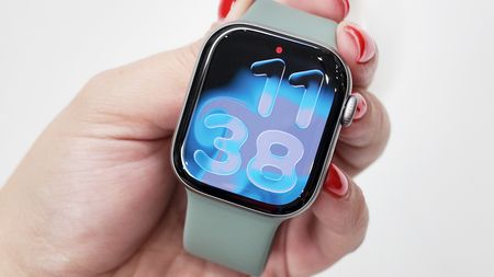 Apple Watch Series 11 close-up