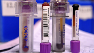 Four blood samples in clear plastic containers with purple lids are shown on top of what looks like a sheet of paper with figures on it. There is a blurred blue background.