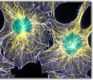 Fluorescence speckle microscopy, which tags a fraction of a protein, can improve image focus and the visibility of structures and dynamics in thick regions of living cells. Here, speckle microscopy illuminates the intricate network of microtubule (yellow) and actin filament (purple) fibers that builds a cell's structure.