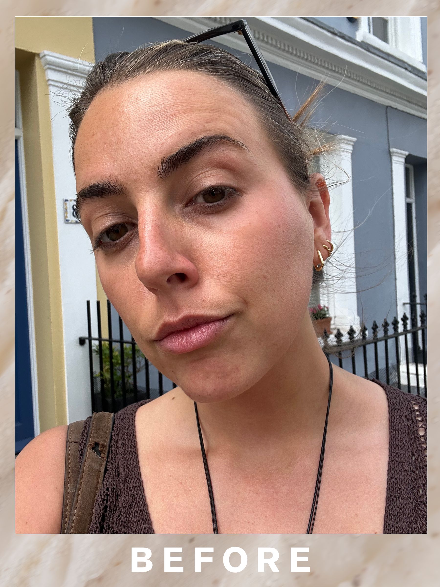 Shannon before her Skin Matters facial