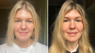 Beauty Editor Fiona McKim pictured before her polynucleotide treatment on the left, with some lines and shadows under her eyes, then on the right two months after her treatment, with smoother and brighter under eyes