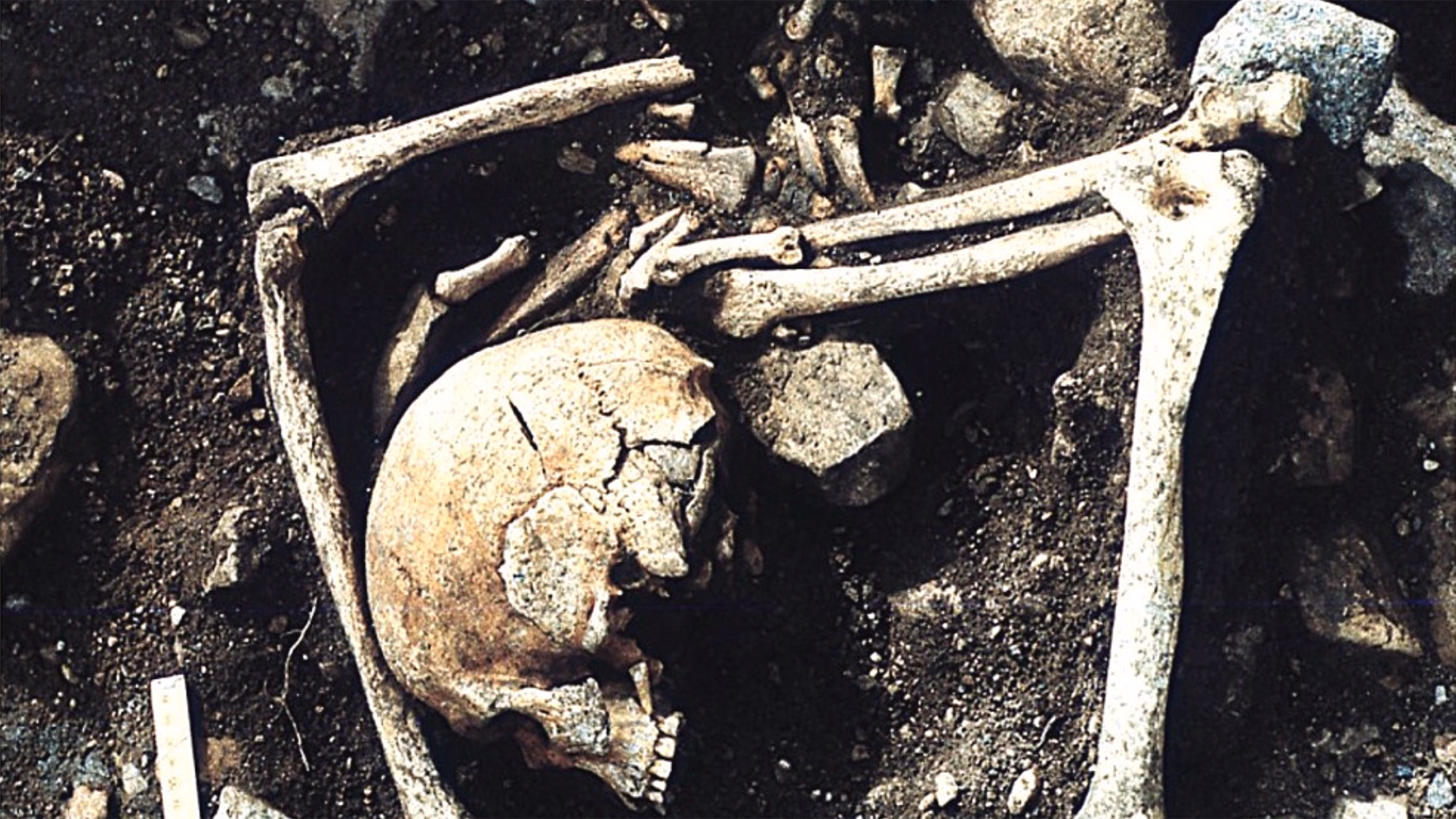 A close up of a half unearthed skull and its corresponding skeleton.
