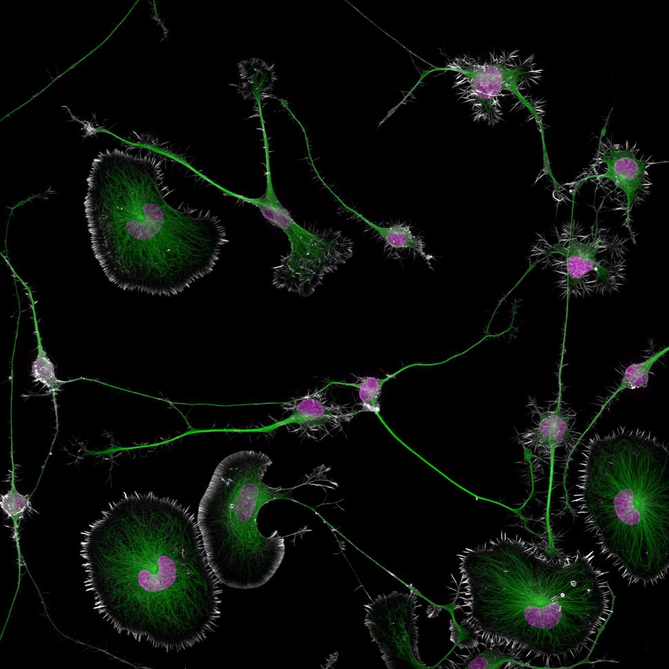 Células tumorais cerebrais diferenciadas de camundongo (actina, microtúbulos e núcleos)