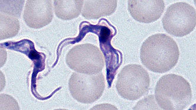 A photo of Trypanosoma brucei gambiense, the parasite that causes sleeping sickness or human African trypanosomiasis.