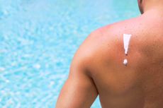 sunscreen, sunburn