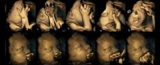 Disturbing ultrasounds show how babies are affected by smoking in the womb