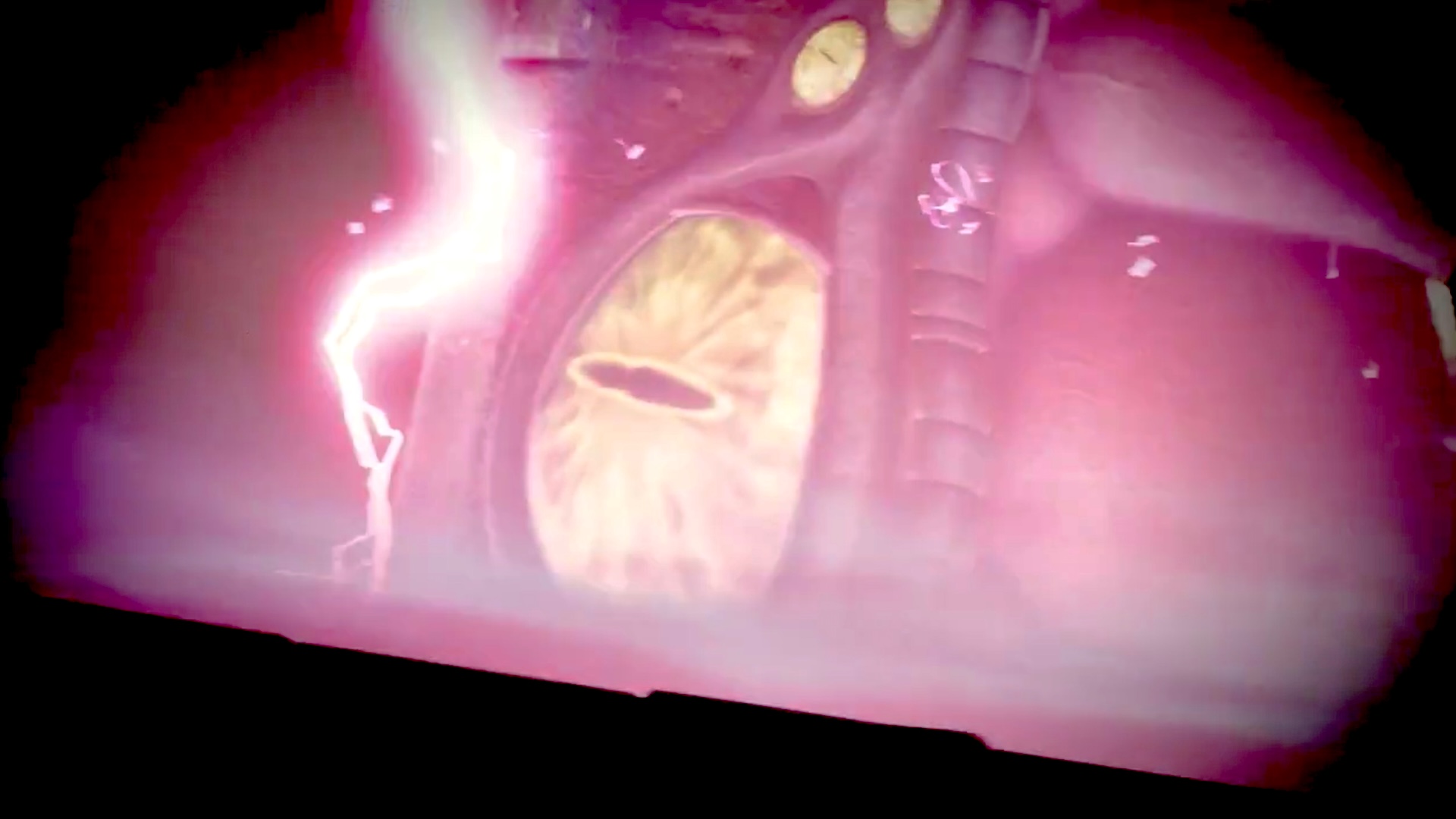 A huge yellow eye on a pink tentacle. Pink electricity crackles beside it.