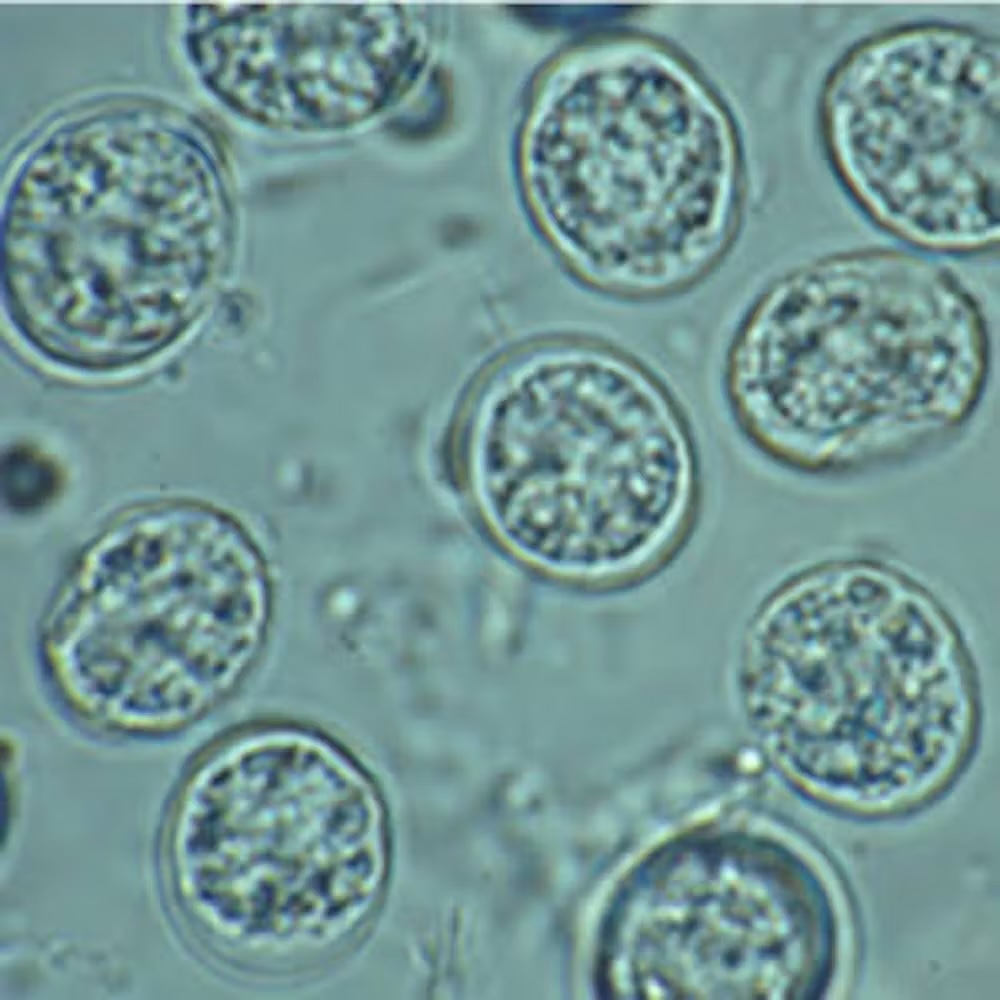 a microscope image of round microorganisms