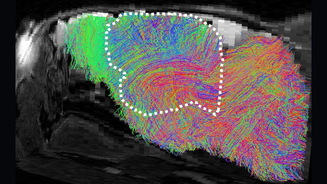 A side view of a mouse's brain with nerve fibers labeled in bright colors