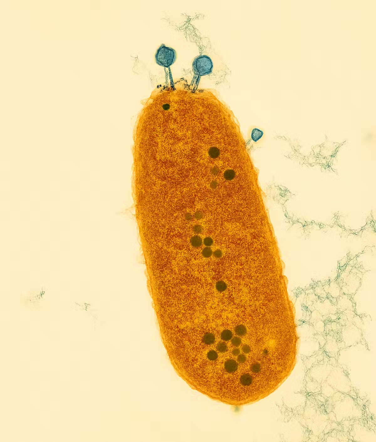 a microscope image with a rod-shaped bacterium in orange covered in blue dots