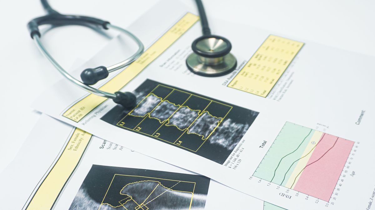 What is bone density? Biology Diagrams