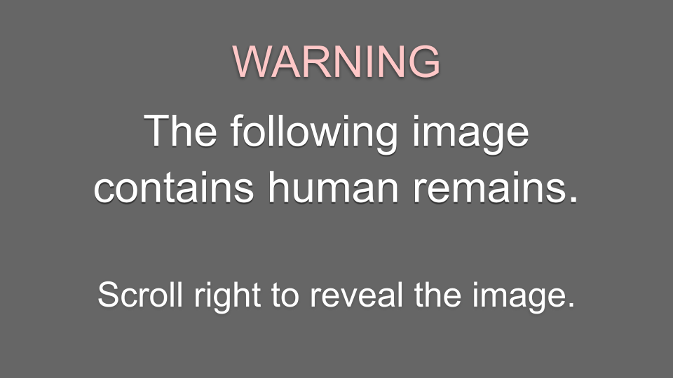 Sensitive content warning. The following image contains human remains.