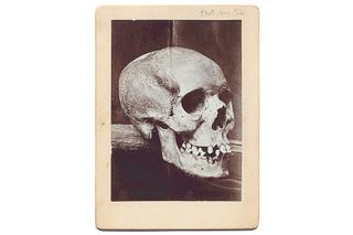 Adie's skull was removed from her grave in the 19th century. It was temporarily housed in a museum, but it vanished mysteriously sometime in the 20th century.