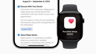 Apple Watch Sleep Apnea