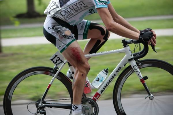 After several crashes a few riders contributed some skin to this year International Classic.